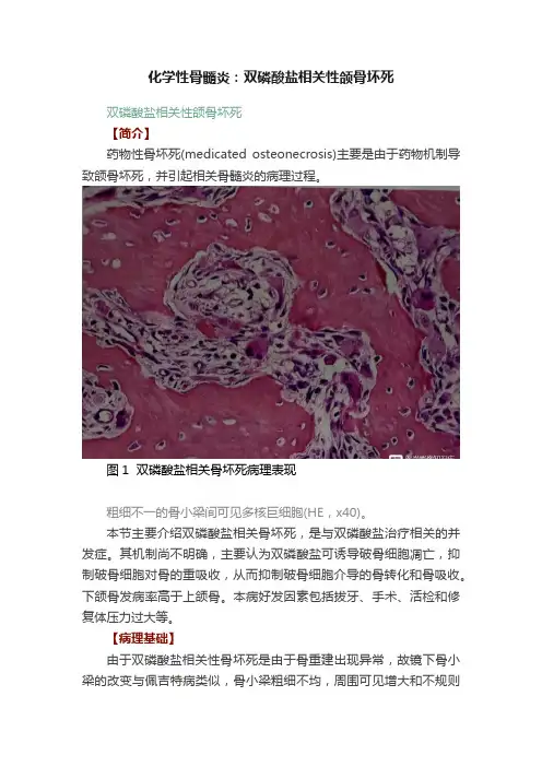 化学性骨髓炎：双磷酸盐相关性颌骨坏死