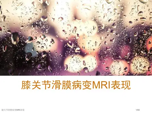 膝关节滑膜病变MRI表现