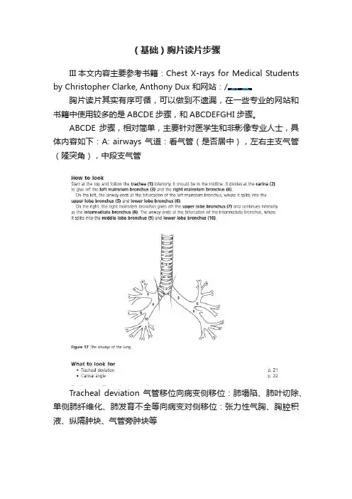 （基础）胸片读片步骤