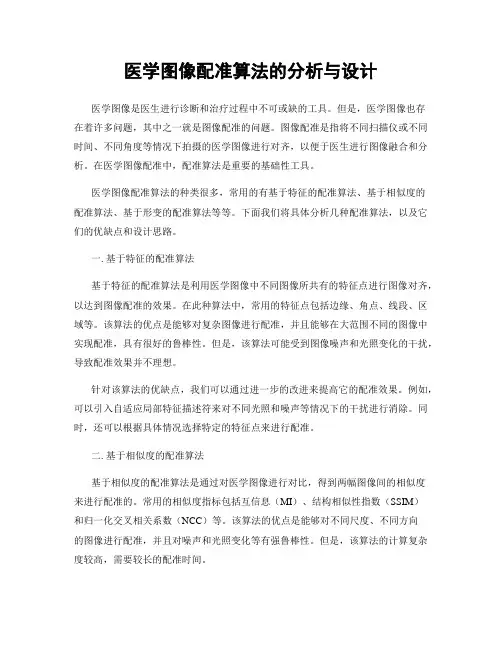 医学图像配准算法的分析与设计