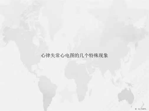 心律失常心电图的几个特殊现象讲课文档