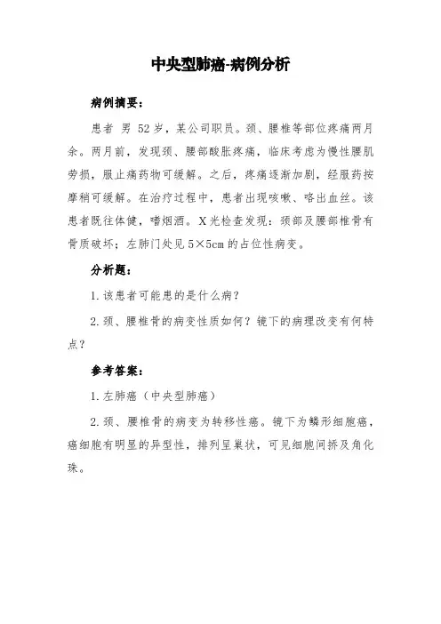 中央型肺癌-病例分析