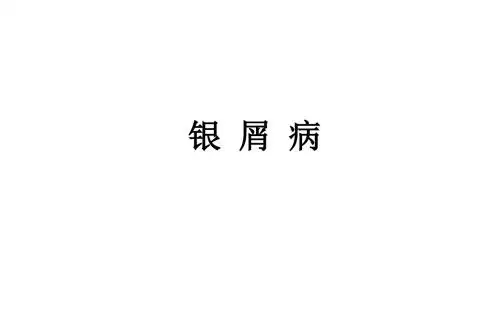 银屑病