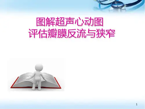 (医学课件)图解超声心动图评估瓣膜反流程度PPT幻灯片