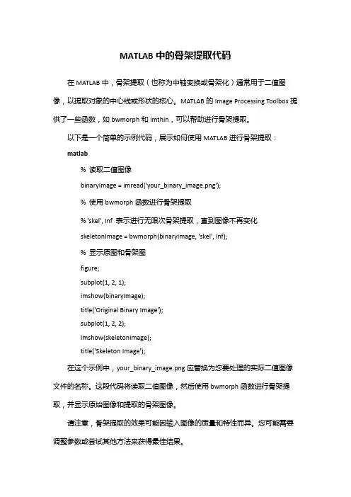 matlab 骨架提取代码