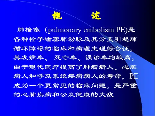 肺动脉栓塞医学PPT课件