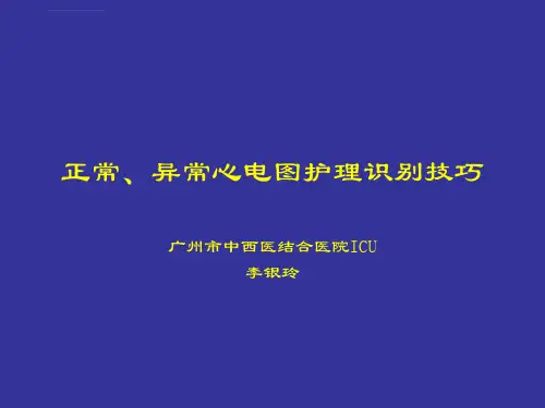 正常异常心电图护理识别技巧ppt课件