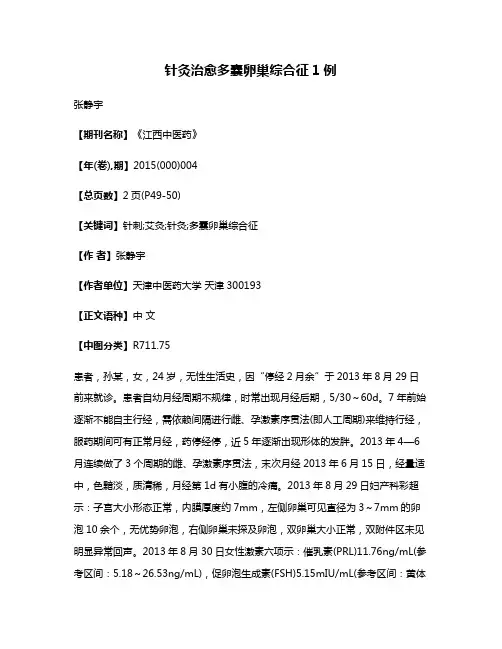 针灸治愈多囊卵巢综合征1例