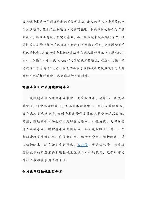 腹腔镜宣传资料