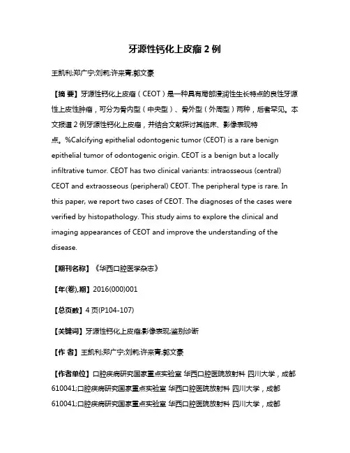 牙源性钙化上皮瘤2例
