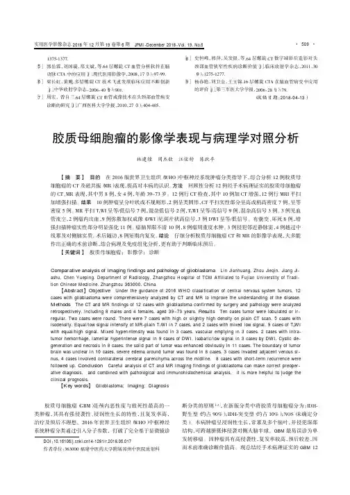 胶质母细胞瘤的影像学表现与病理学对照分析