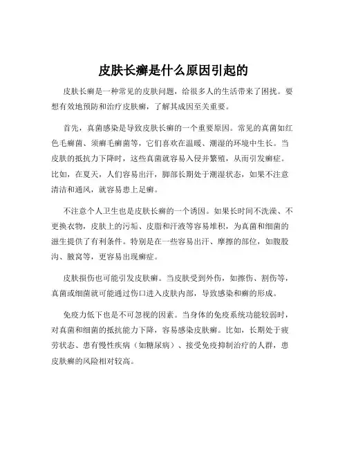 皮肤长癣是什么原因引起的