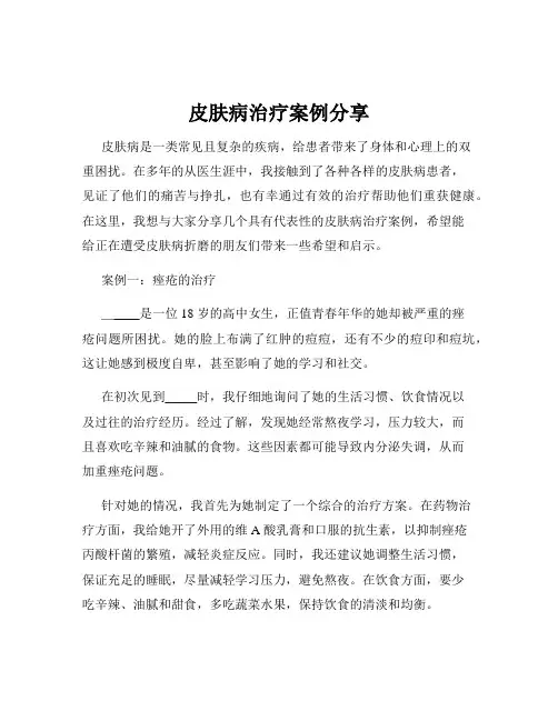 皮肤病治疗案例分享