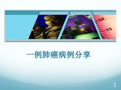 病例分享PPT演示课件