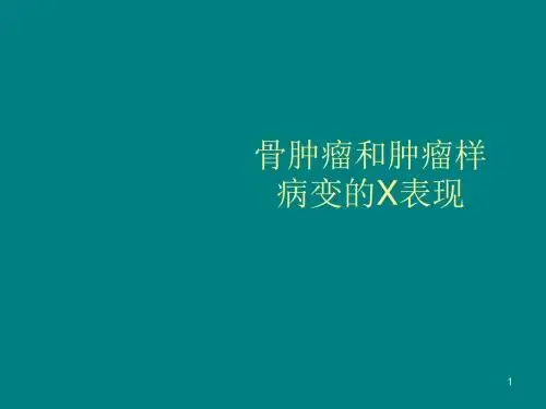 骨肿瘤X线表现ppt课件