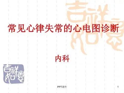 常见心电图诊断  ppt课件