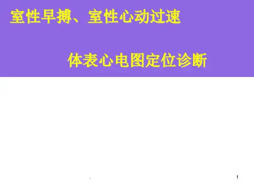 室性早搏室性心动过速的体表心电图定位诊断ppt课件