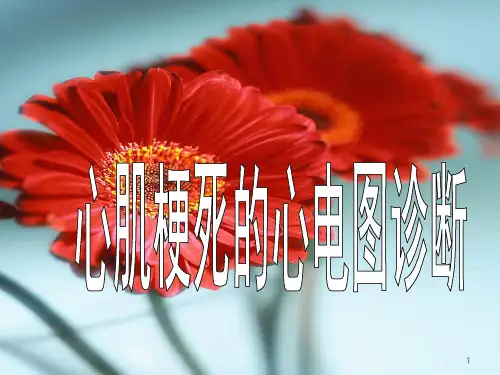 心肌梗死的心电图诊断ppt课件
