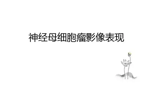 神经母细胞瘤影像表现