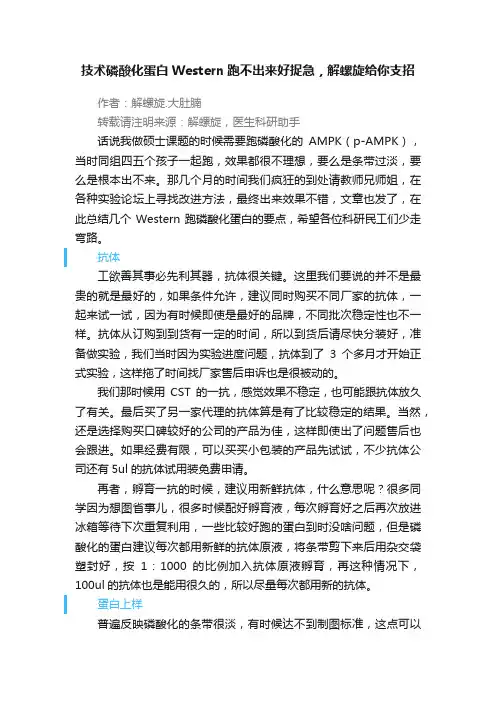 技术磷酸化蛋白Western跑不出来好捉急,解螺旋给你支招
