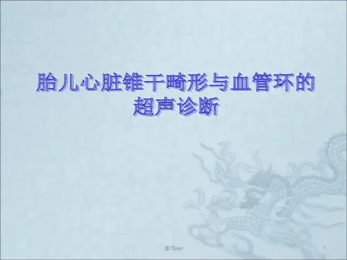 胎儿心脏锥干畸形