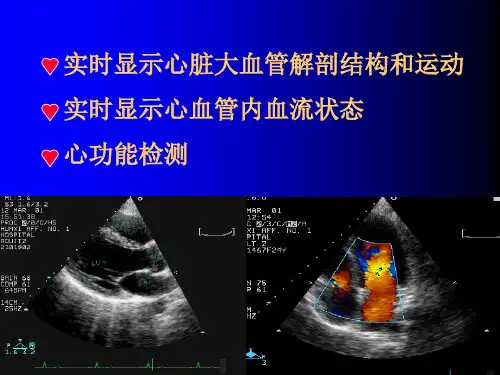如何阅读超声心动图报告