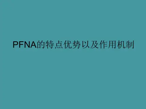 股骨近端骨折使用PFNA治疗的特点优势以及作用机制