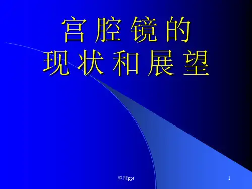 宫腔镜的现状和展望【78页】