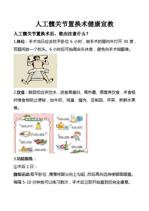 人工髋关节置换术健康宣教