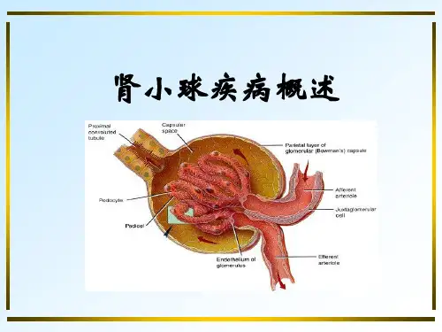肾小球疾病概述 PPT