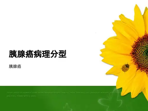 胰腺癌病理分型