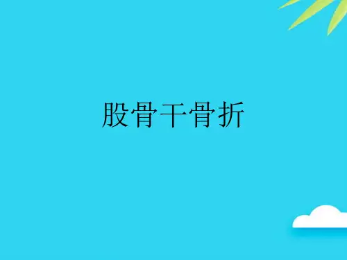 股骨干骨折优质PPT资料
