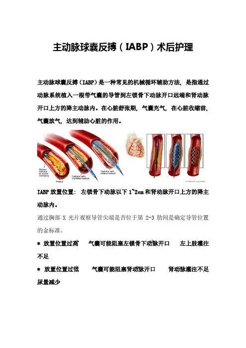 主动脉球囊反搏(IABP)术后护理