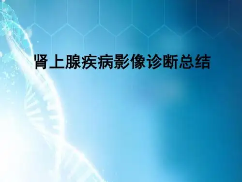肾上腺疾病影像诊断总结ppt课件