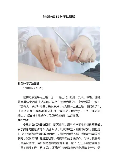 针灸补泻12种手法图解