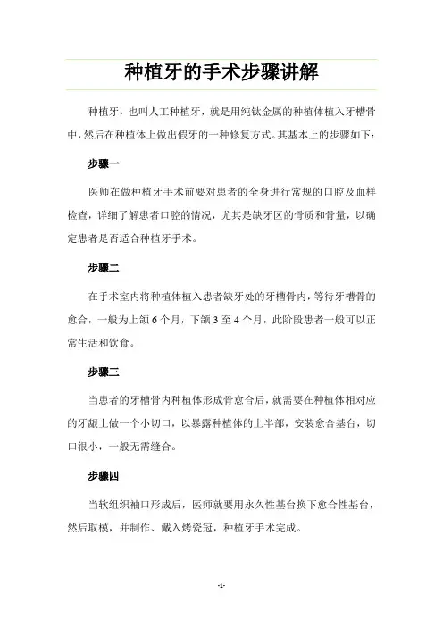 种植牙的手术步骤讲解