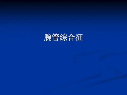 腕管综合征