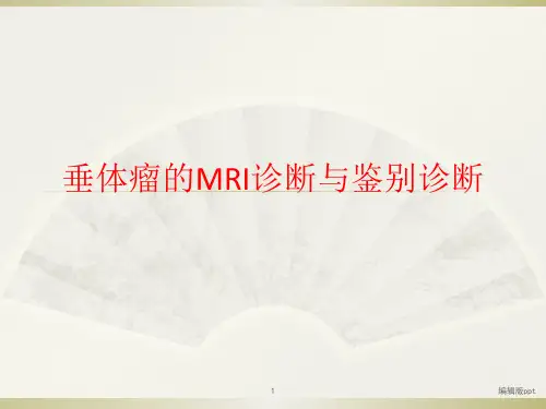 垂体瘤MR表现PPT课件