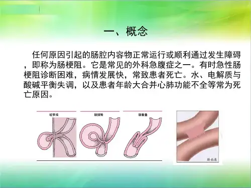 肠梗阻护理常规PPT通用课件