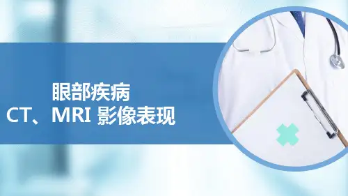 眼CT、MRI影像表现