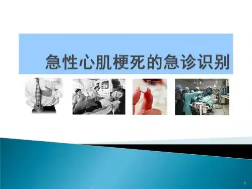 (医学课件)急性心肌梗死的急诊识别ppt演示课件
