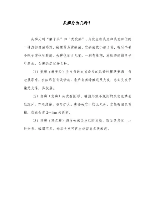 头癣分为几种？