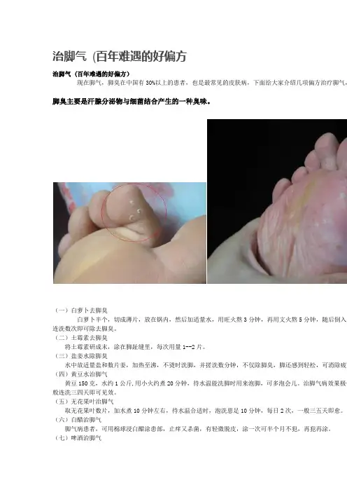治脚气