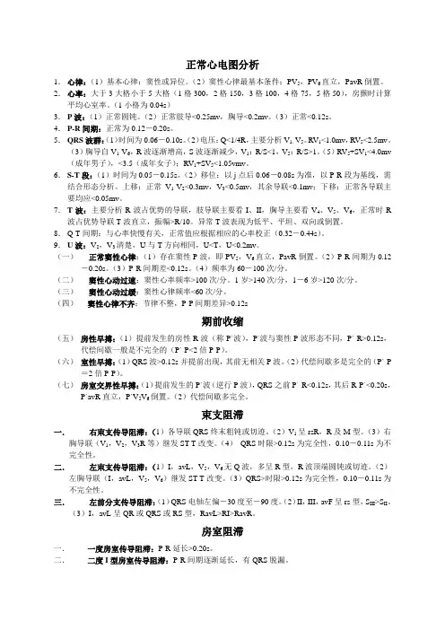 心电图诊断标准