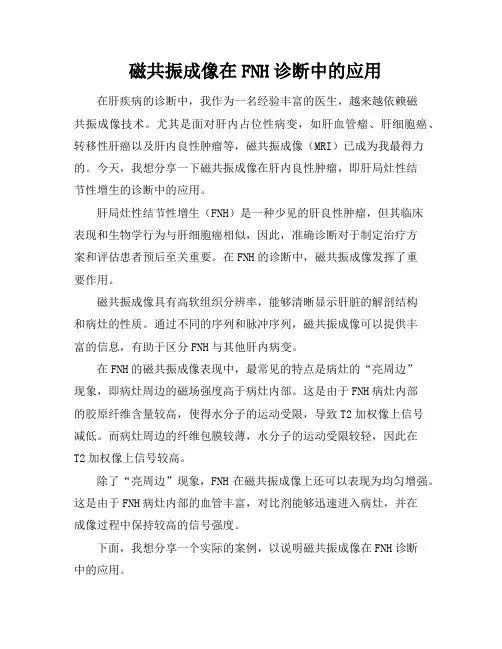 磁共振成像在FNH诊断中的应用
