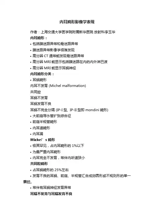 内耳畸形影像学表现