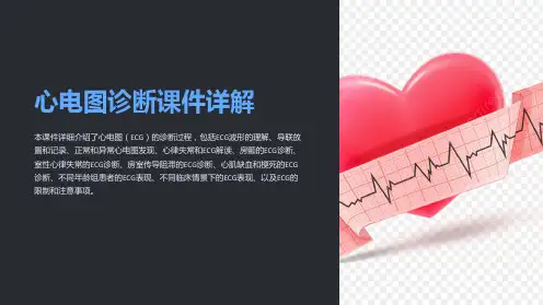 心电图诊断课件详解