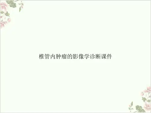 椎管内肿瘤的影像学诊断ppt课件