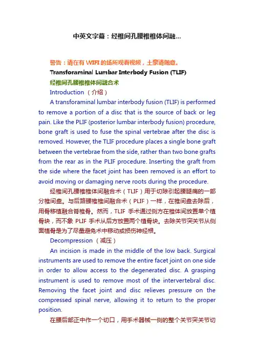 中英文字幕：经椎间孔腰椎椎体间融...
