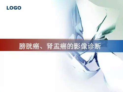 膀胱癌、肾盂癌的影像诊断